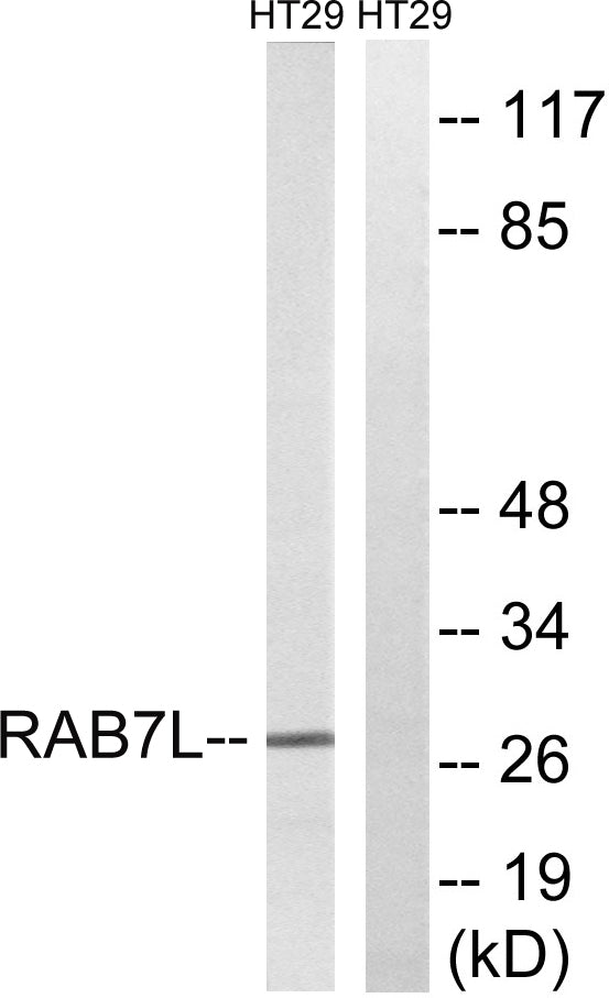 Rab 7L1 Rabbit Polyclonal Antibody