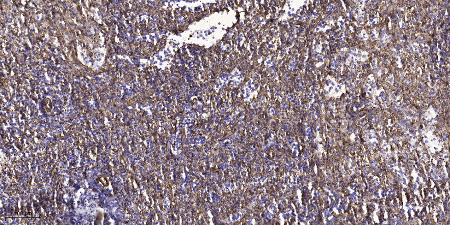 Rab L5 Rabbit Polyclonal Antibody