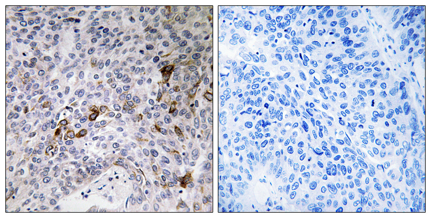 Rab11-FIP3 Rabbit Polyclonal Antibody