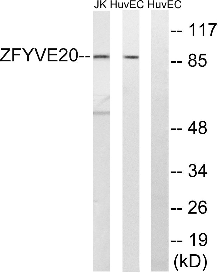 Rabenosyn-5 Rabbit Polyclonal Antibody