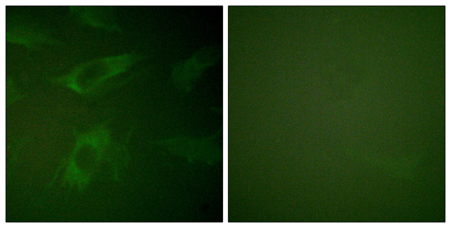 Rabphilin-3A Rabbit Polyclonal Antibody