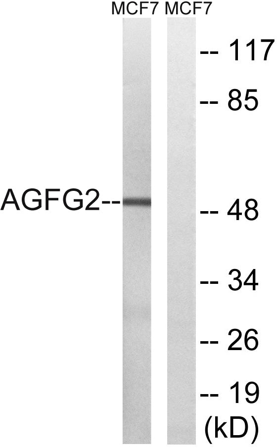 Rabr Rabbit Polyclonal Antibody