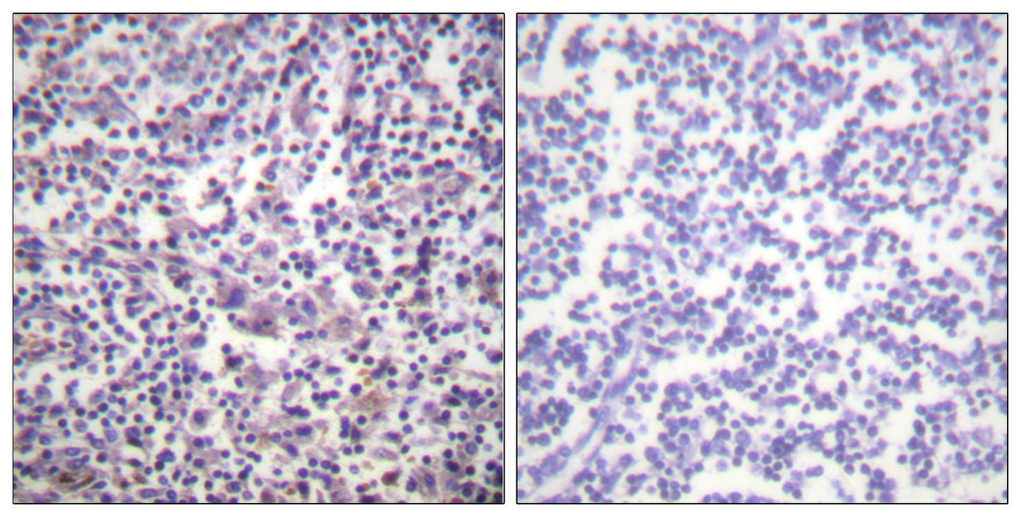 Raf-B Rabbit Polyclonal Antibody