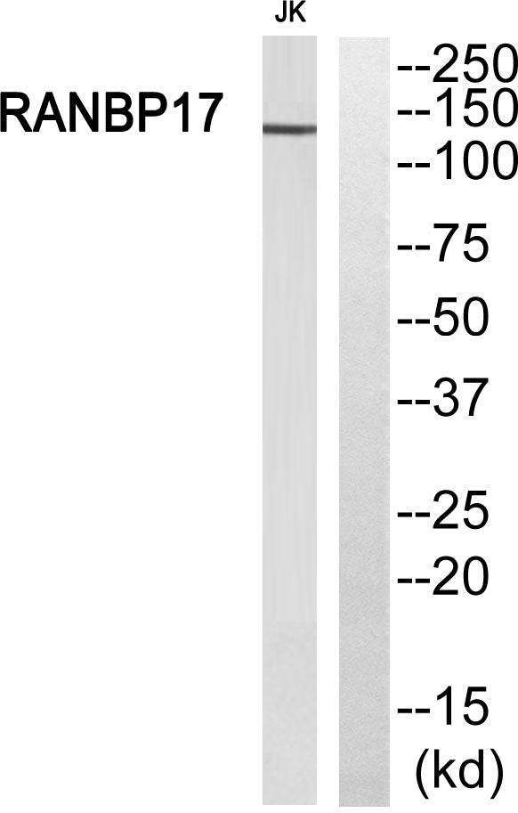 Ran BP-17 Rabbit Polyclonal Antibody