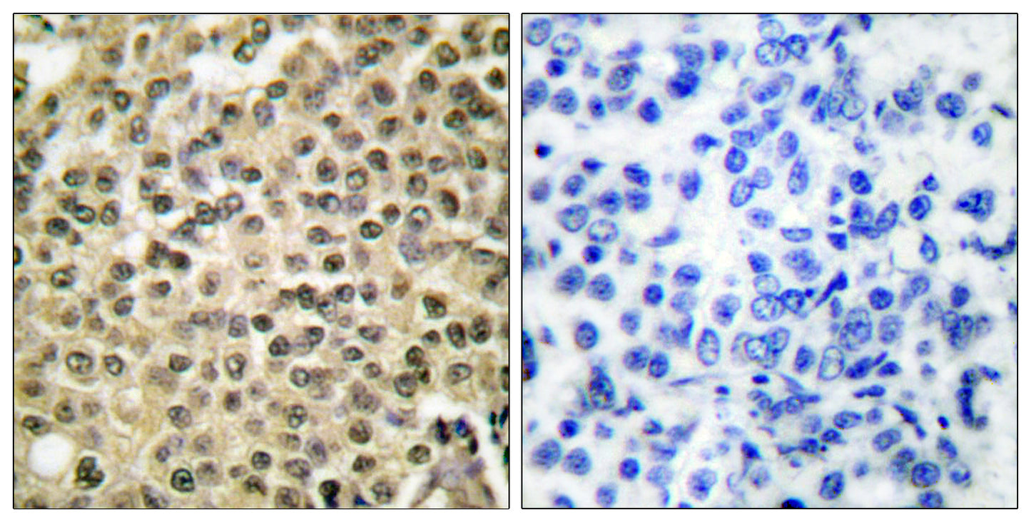 Ran Rabbit Polyclonal Antibody