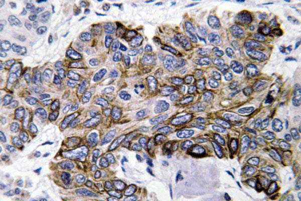 RANTES Rabbit Polyclonal Antibody