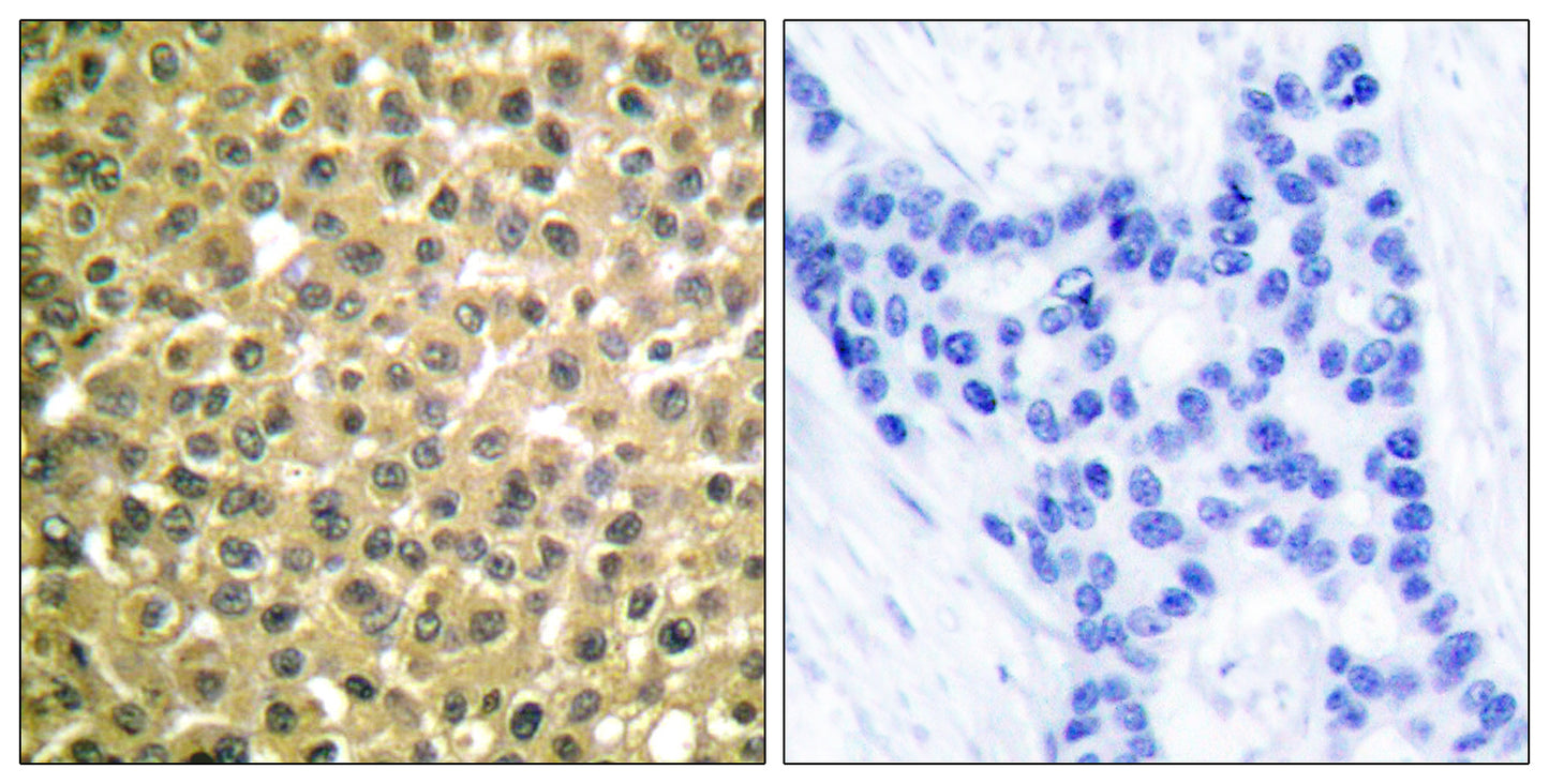 RARβ Rabbit Polyclonal Antibody