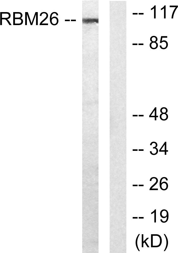 RBM26 Rabbit Polyclonal Antibody