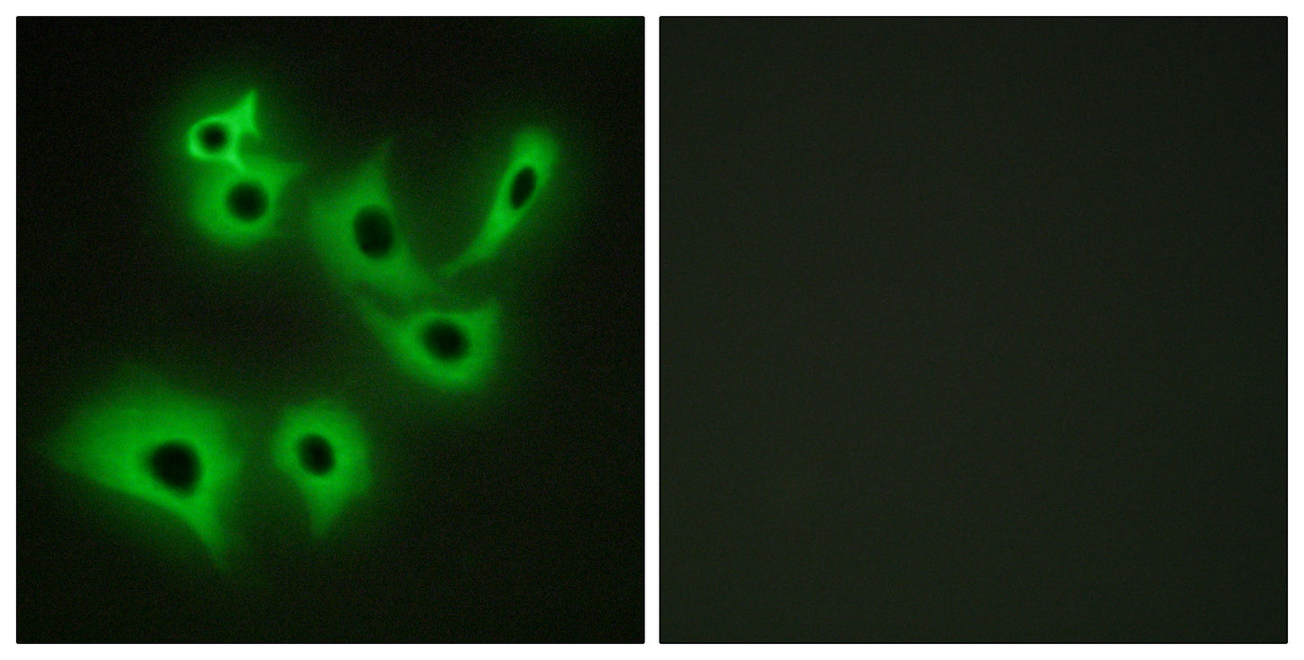 R-cadherin Rabbit Polyclonal Antibody
