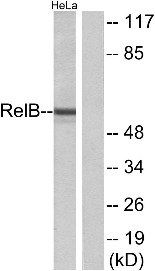 RelB Rabbit Polyclonal Antibody
