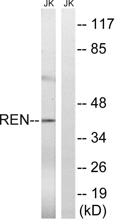 Renin Rabbit Polyclonal Antibody