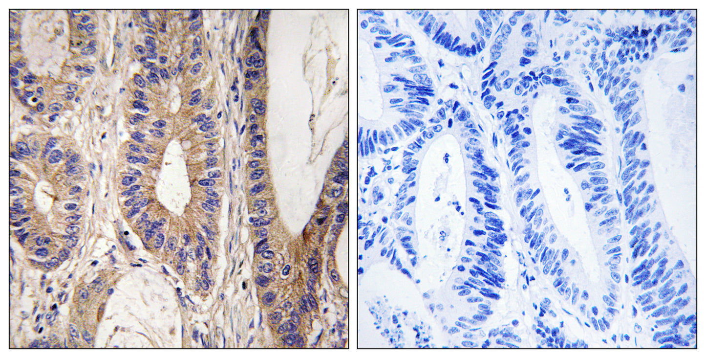 Rent1 Rabbit Polyclonal Antibody