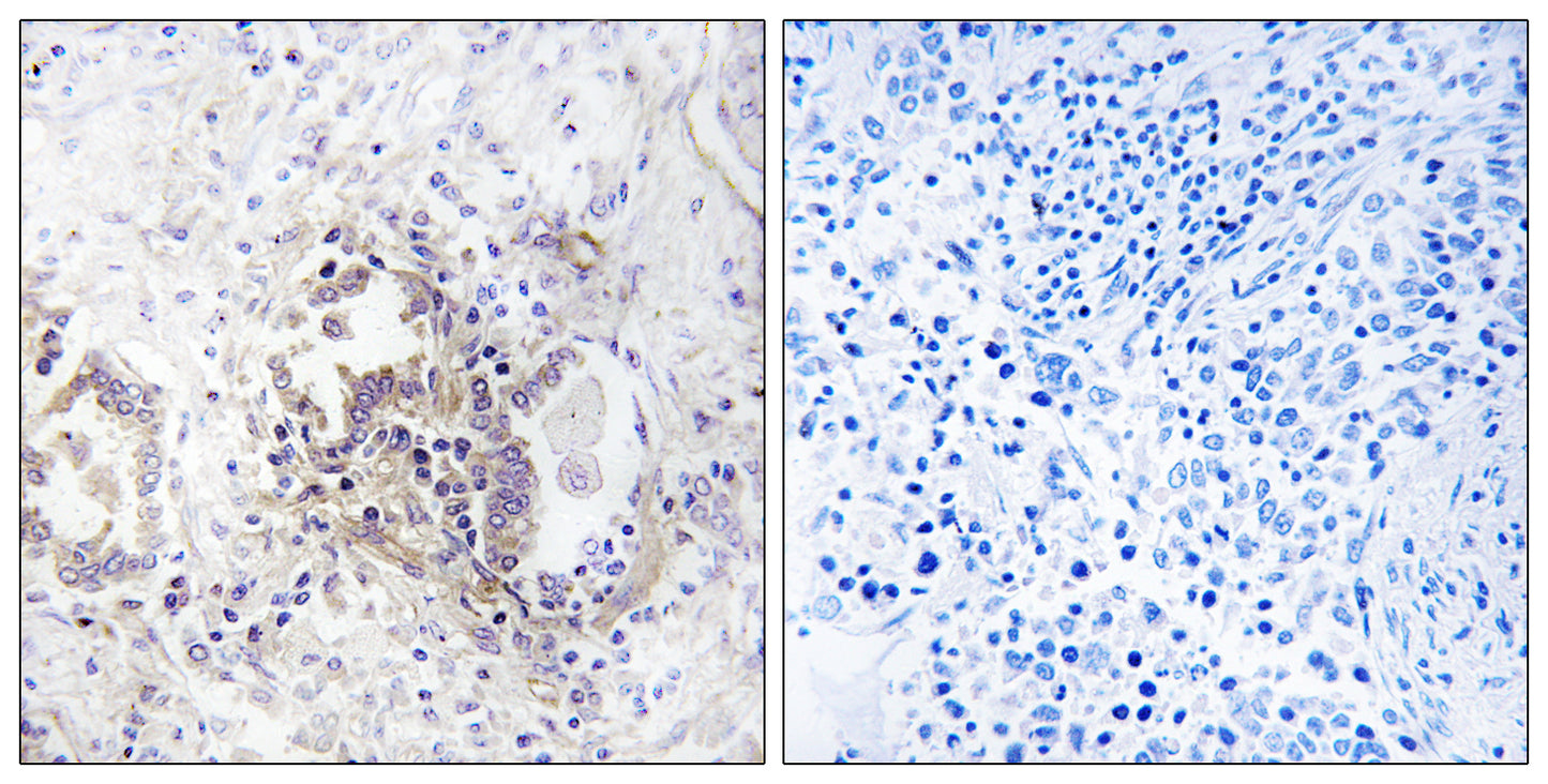 REP-2 Rabbit Polyclonal Antibody