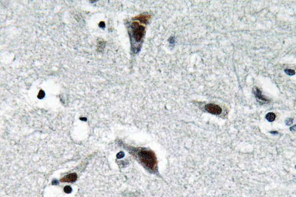 RFC3 Rabbit Polyclonal Antibody