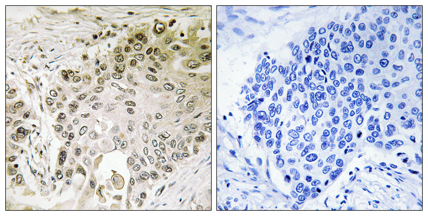 RFX2 Rabbit Polyclonal Antibody