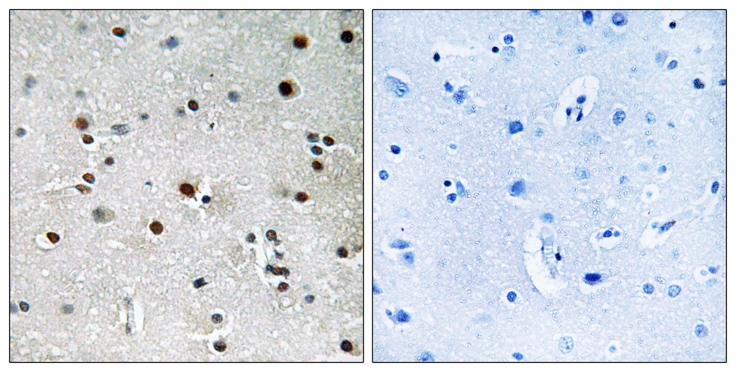 RFX3 Rabbit Polyclonal Antibody