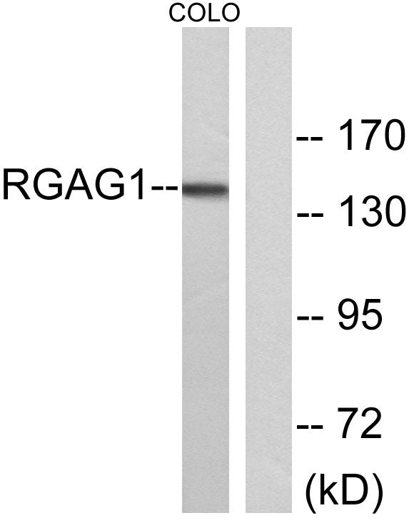 RGAG1 Rabbit Polyclonal Antibody