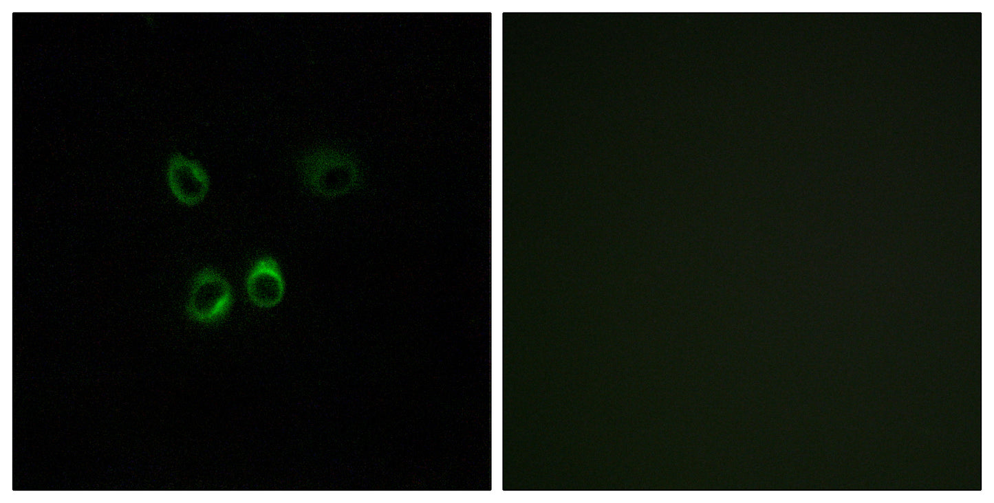 RGR Rabbit Polyclonal Antibody