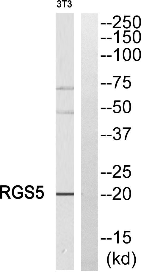 RGS5 Rabbit Polyclonal Antibody