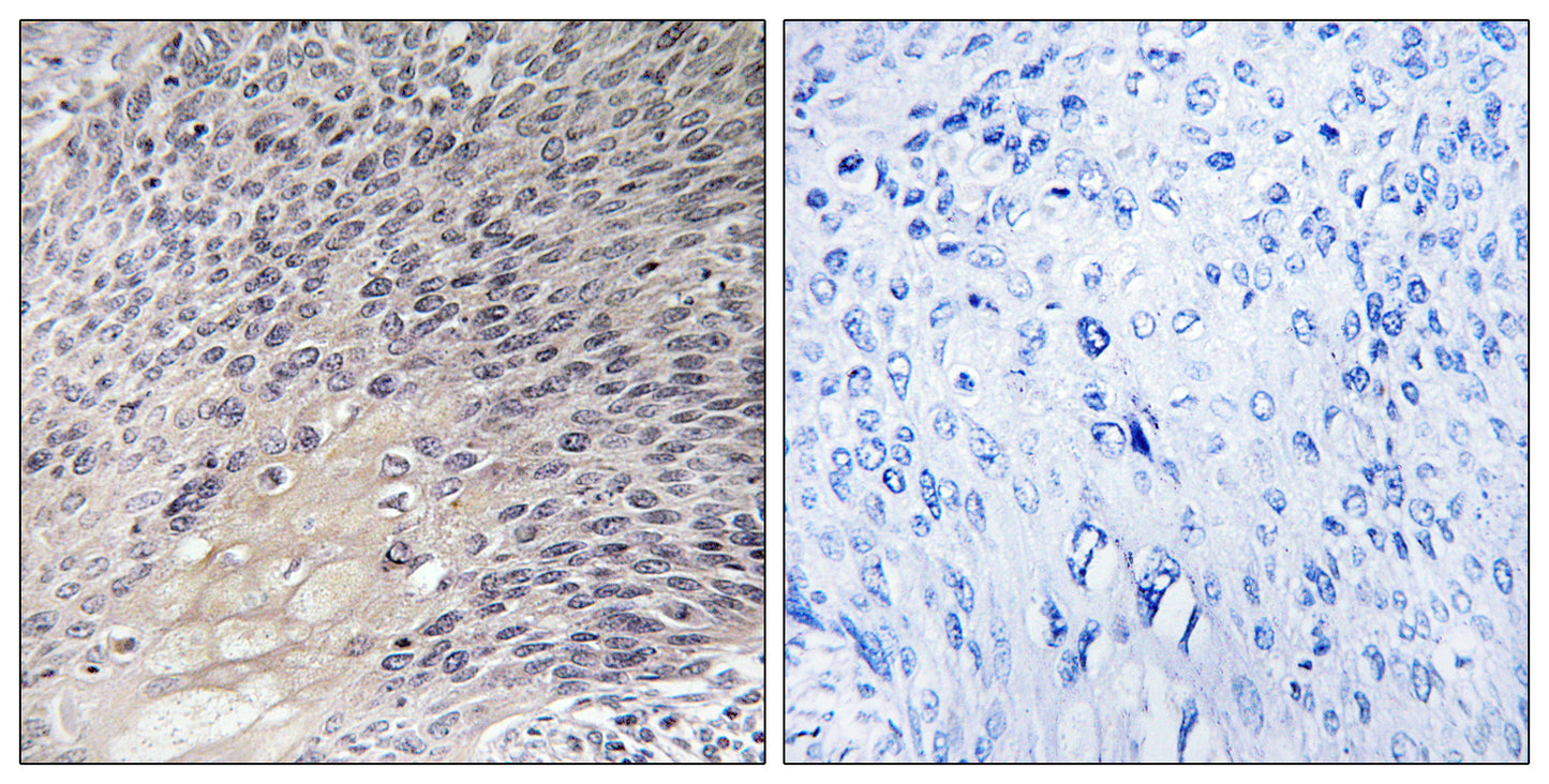 Rho GDIα Rabbit Polyclonal Antibody