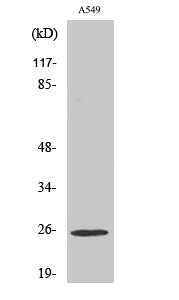 Rho GDIγ Rabbit Polyclonal Antibody