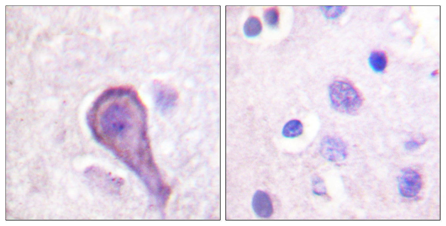 Rhodopsin Rabbit Polyclonal Antibody