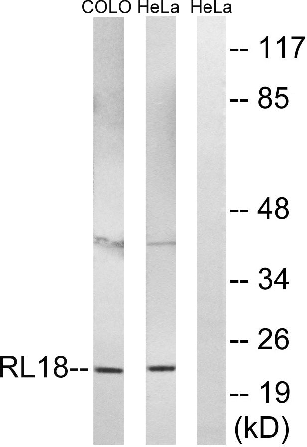 Ribosomal Protein L18 Rabbit Polyclonal Antibody