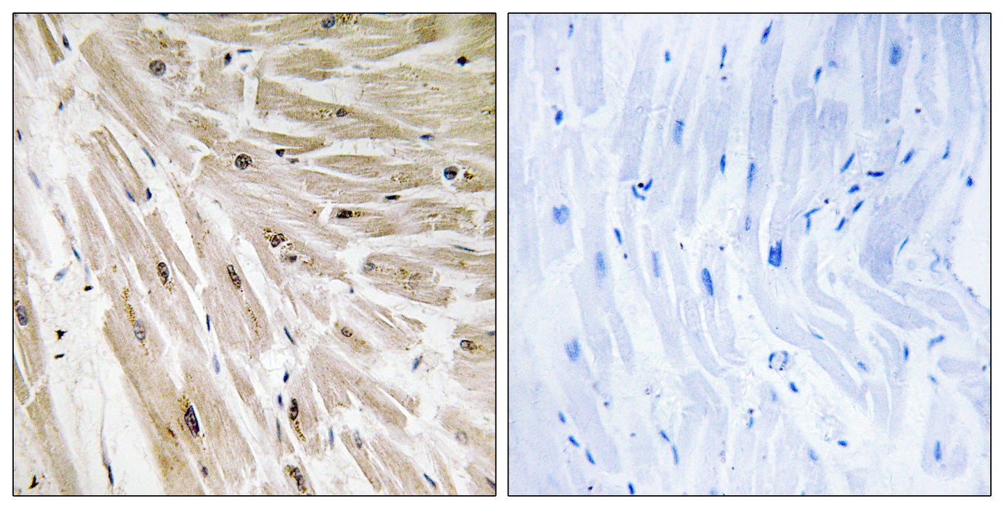 Ribosomal Protein L22 Rabbit Polyclonal Antibody