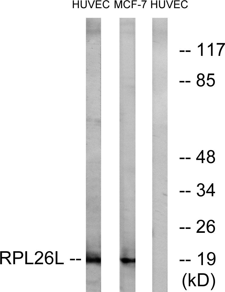 Ribosomal Protein L26L Rabbit Polyclonal Antibody