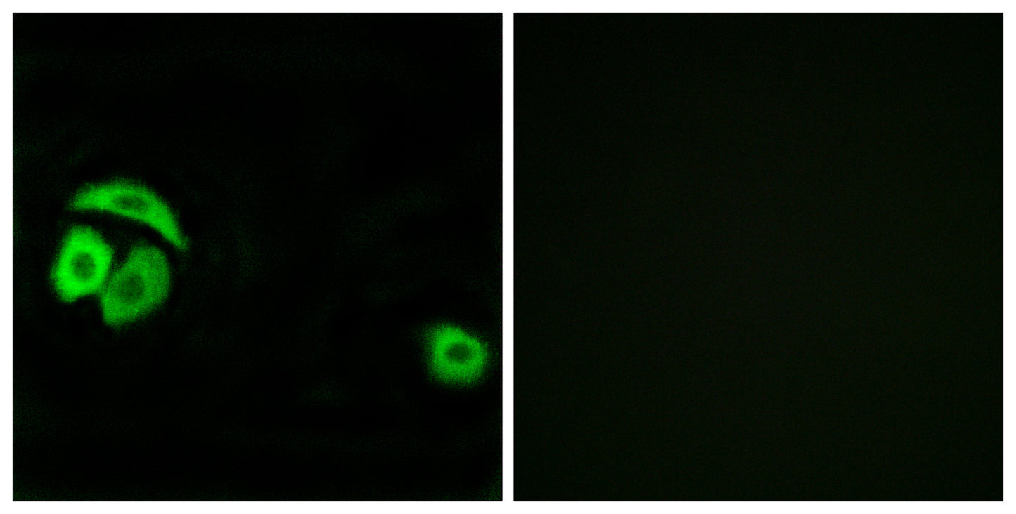 Ribosomal Protein L27A Rabbit Polyclonal Antibody