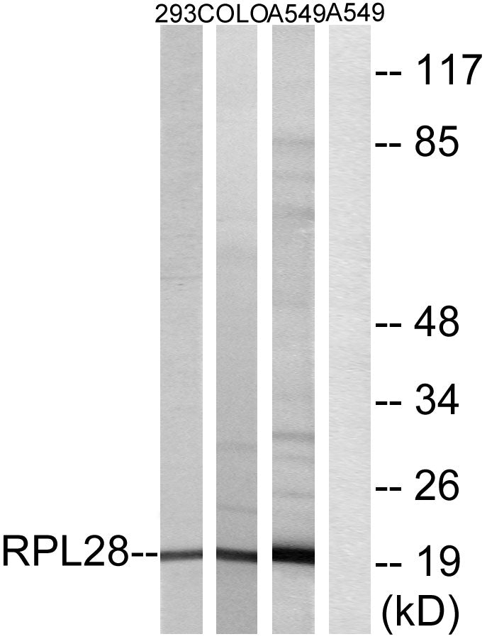 Ribosomal Protein L28 Rabbit Polyclonal Antibody