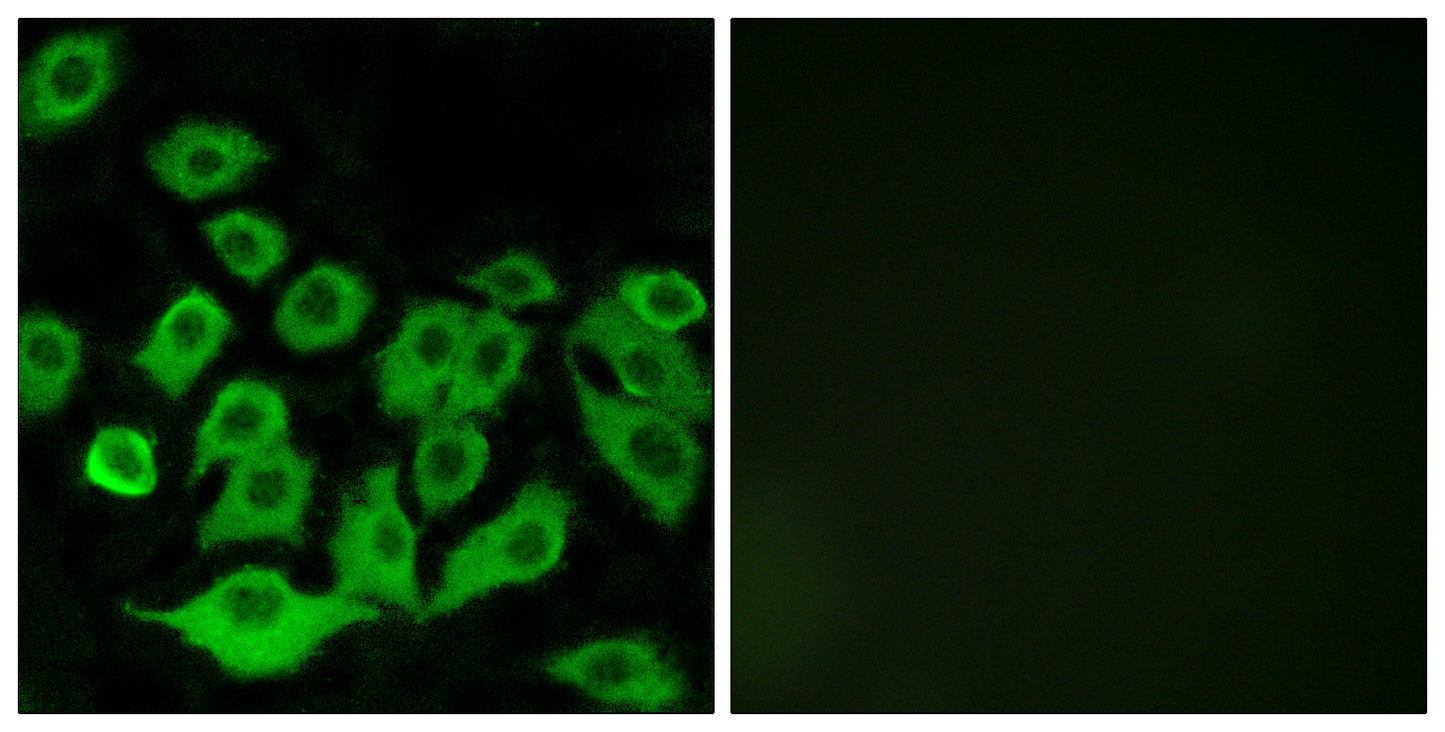 Ribosomal Protein L36 Rabbit Polyclonal Antibody