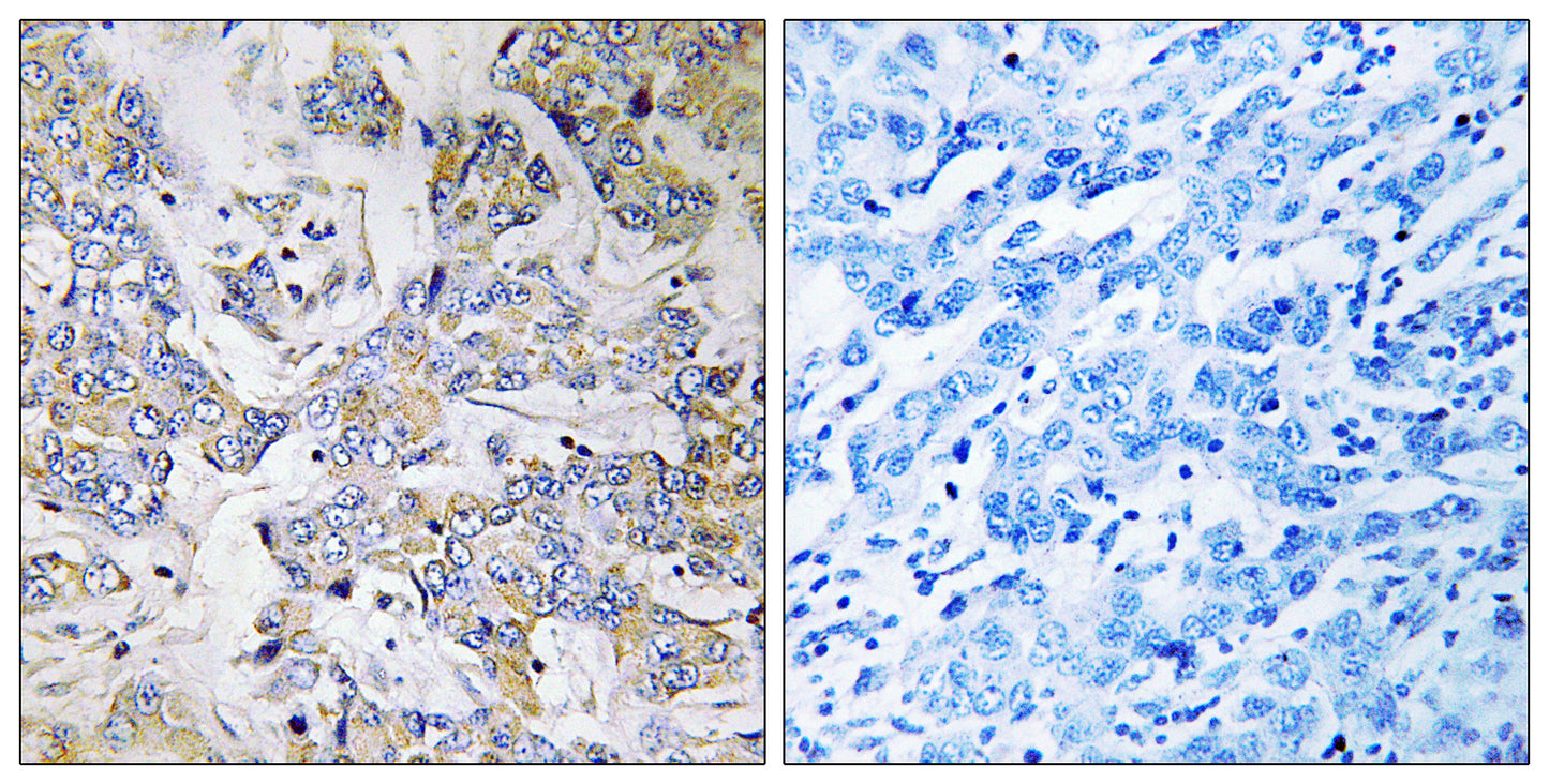 Ribosomal Protein L37 Rabbit Polyclonal Antibody
