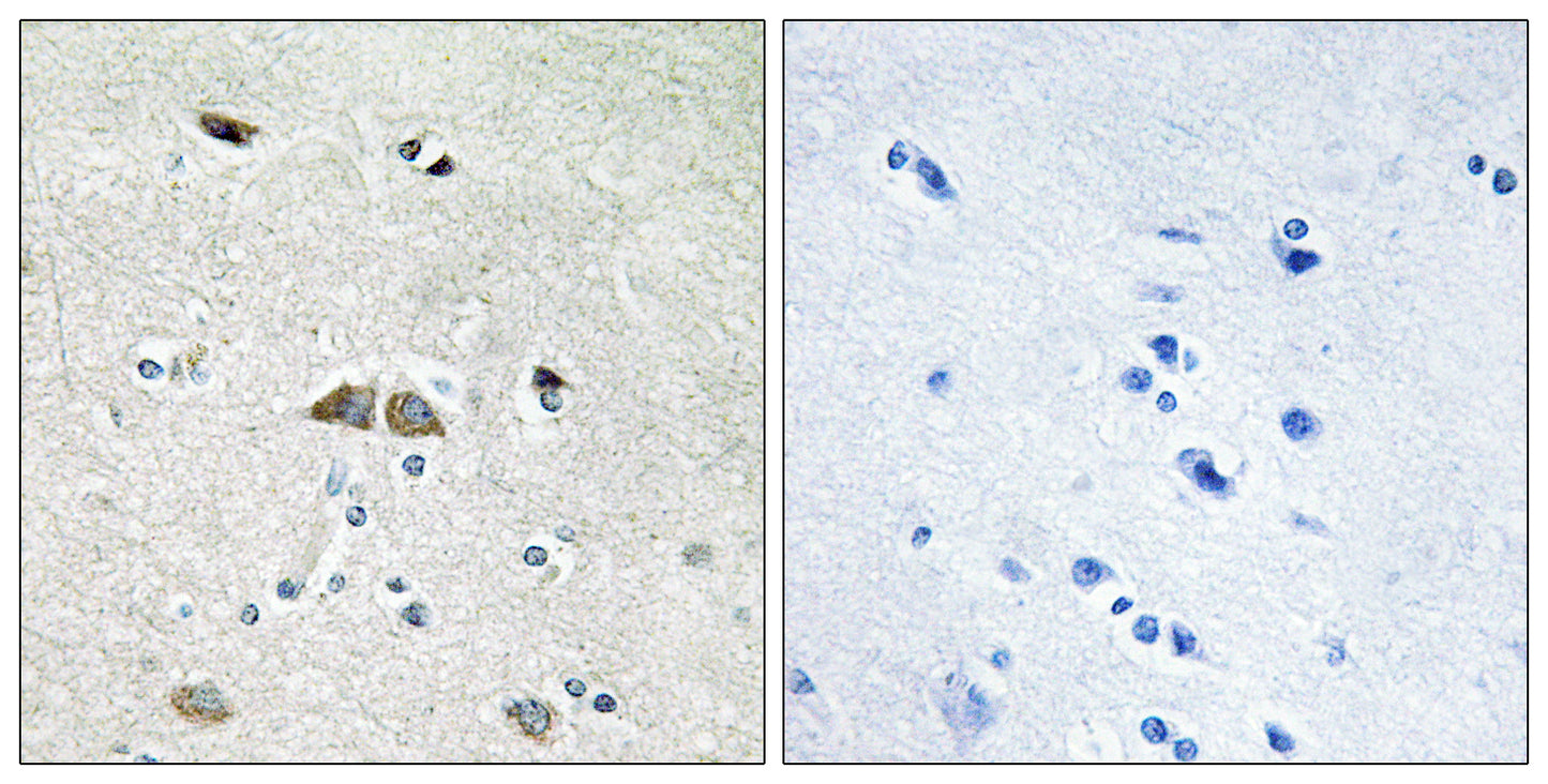 Ribosomal Protein L39L Rabbit Polyclonal Antibody