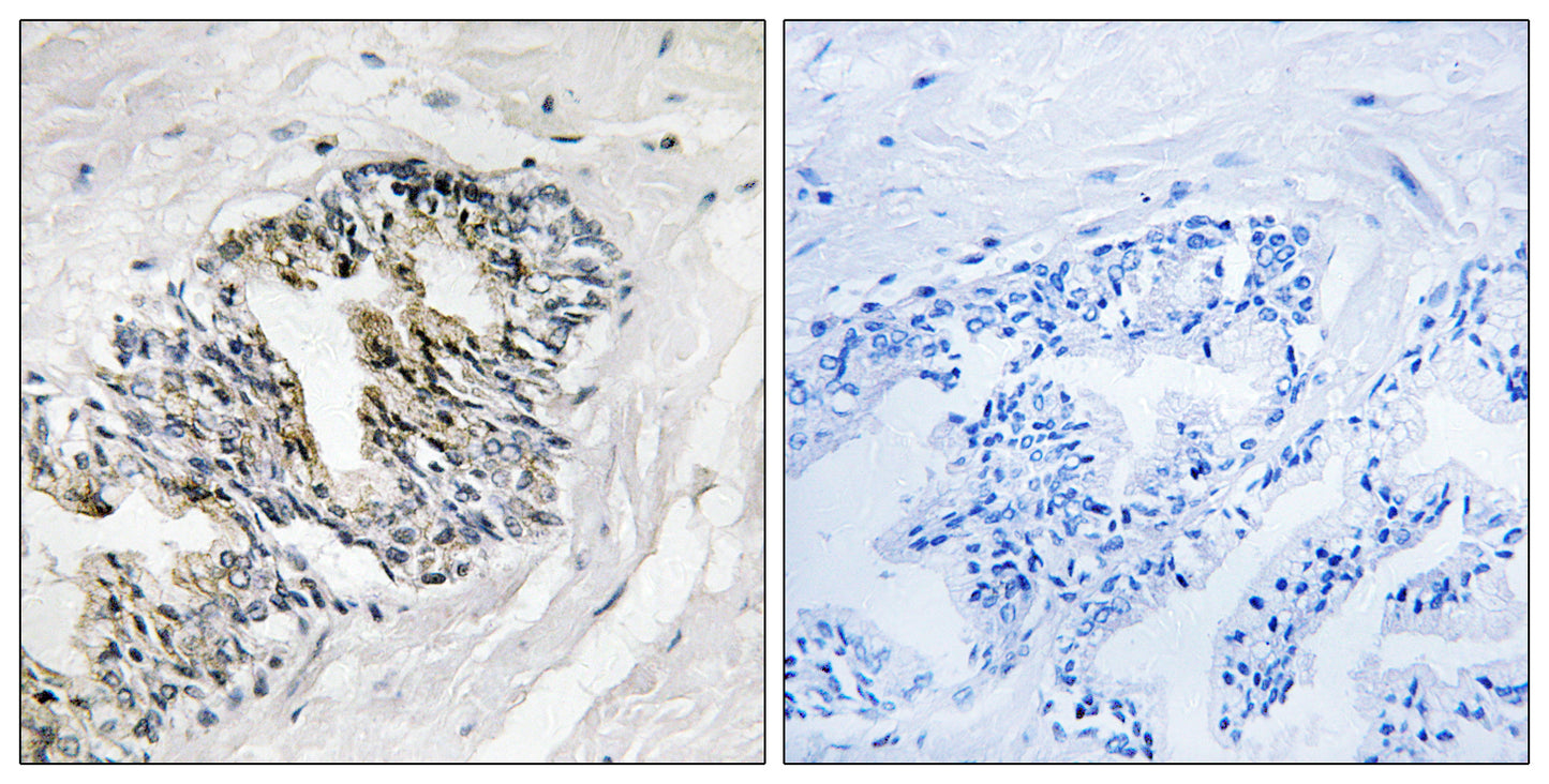 Ribosomal Protein LP2 Rabbit Polyclonal Antibody