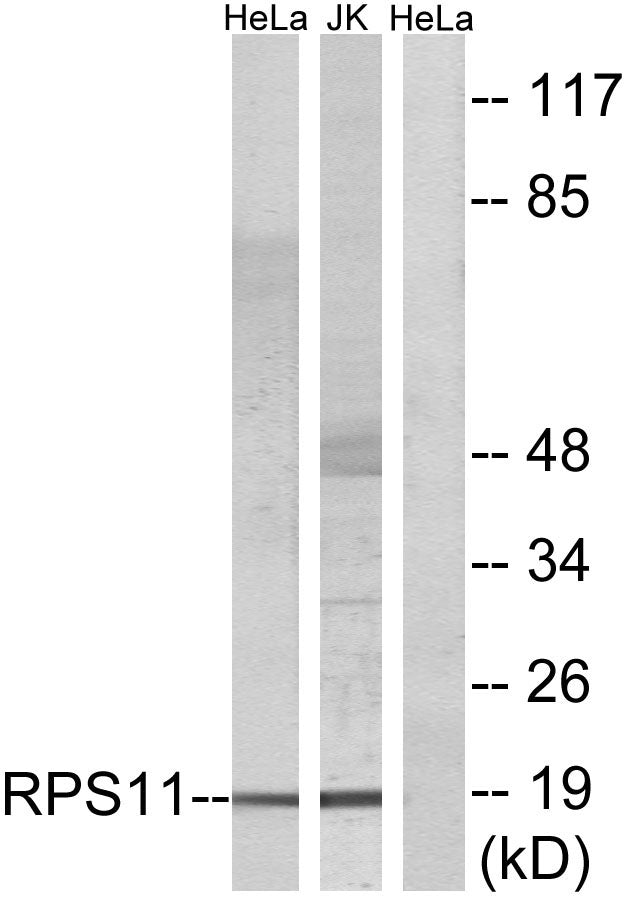 Ribosomal Protein S11 Rabbit Polyclonal Antibody