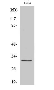 Ribosomal Protein S2 Rabbit Polyclonal Antibody