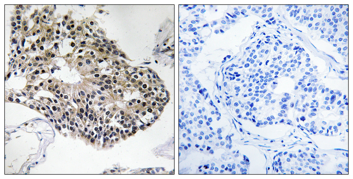 Ribosomal Protein S25 Rabbit Polyclonal Antibody