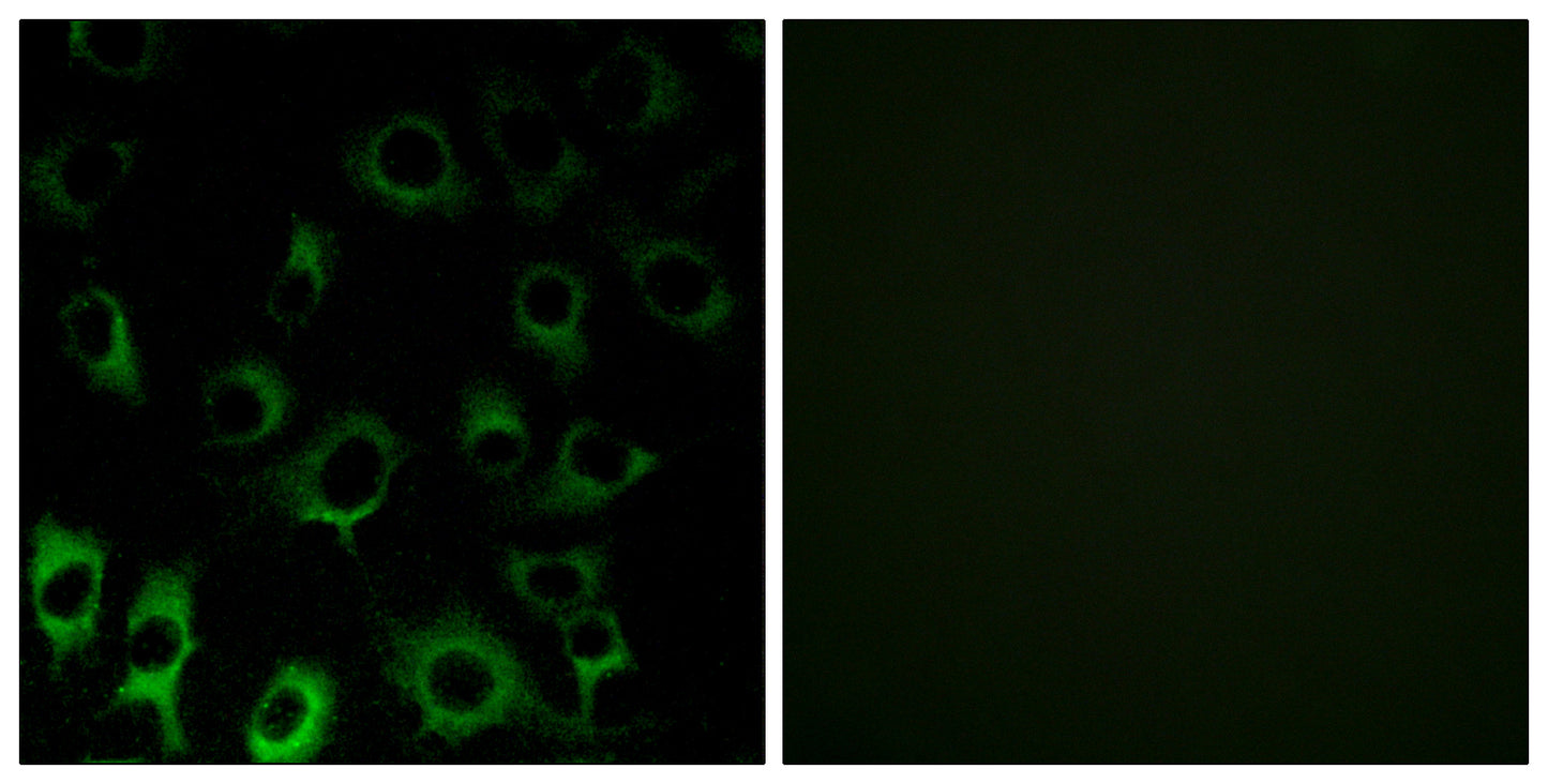 Ribosomal Protein S4X Rabbit Polyclonal Antibody