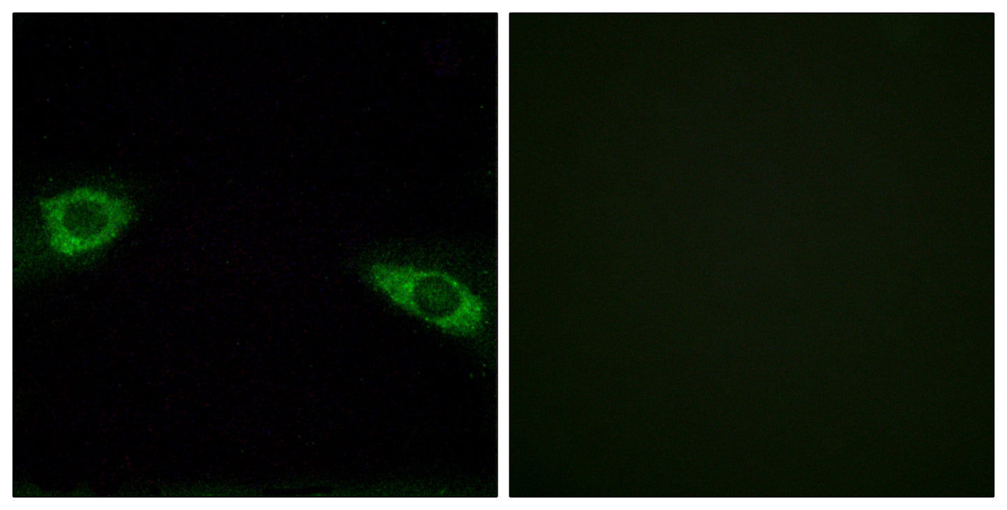 Ribosomal Protein S4Y1 Rabbit Polyclonal Antibody