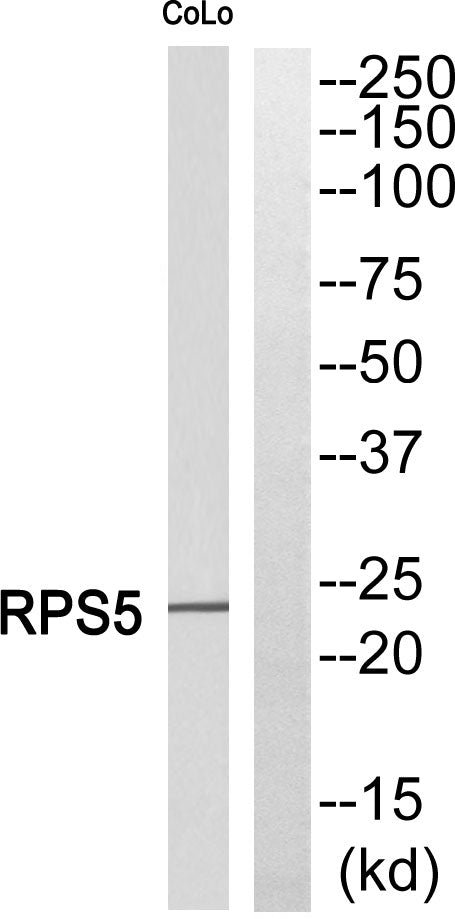 Ribosomal Protein S5 Rabbit Polyclonal Antibody