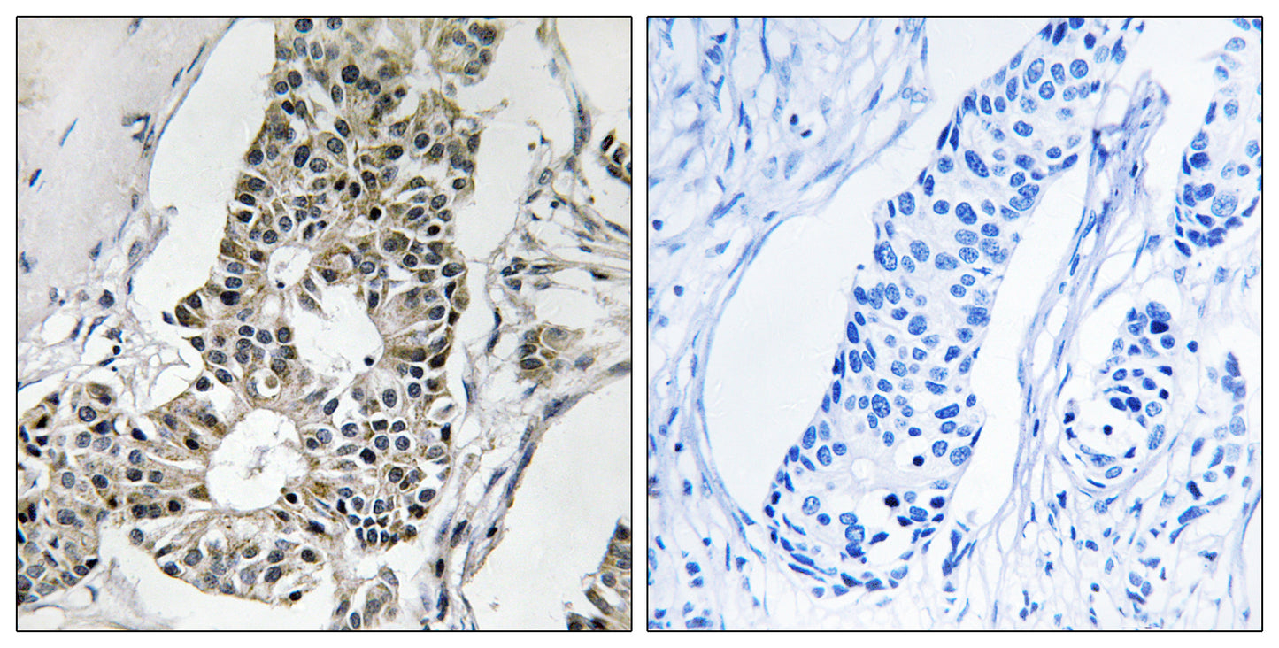 Rim4 Rabbit Polyclonal Antibody
