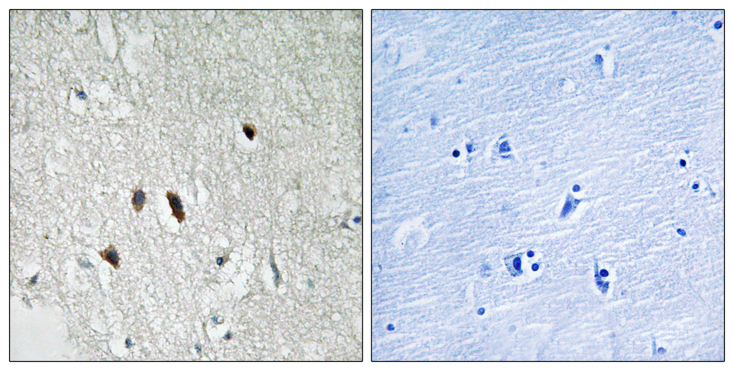 RIP2 Rabbit Polyclonal Antibody