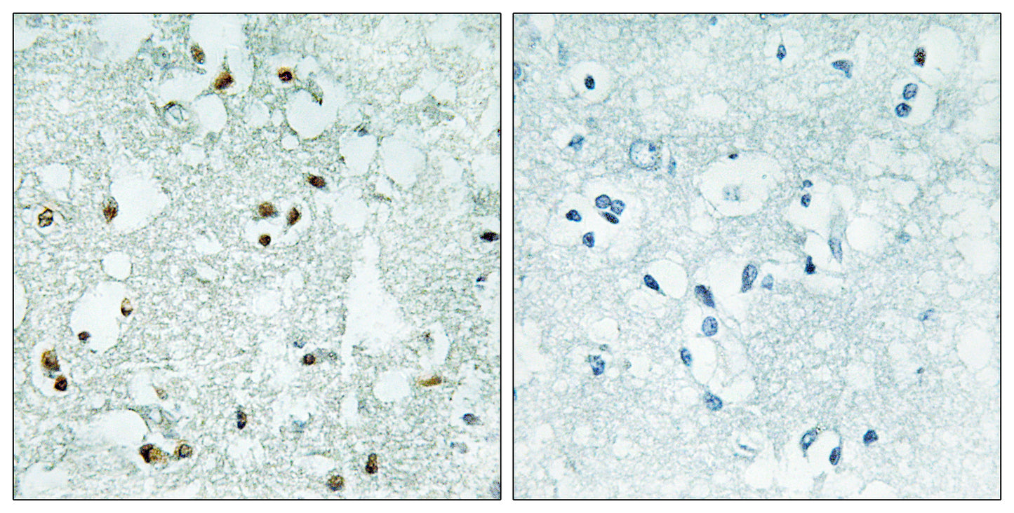RNase Z2 Rabbit Polyclonal Antibody