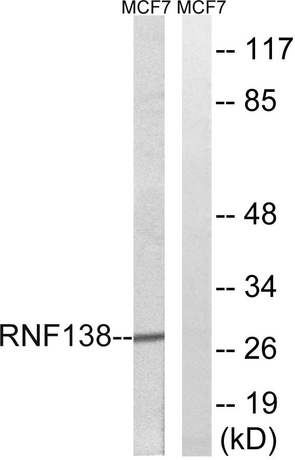 RNF138 Rabbit Polyclonal Antibody