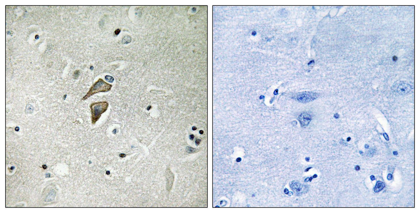 RNF149 Rabbit Polyclonal Antibody