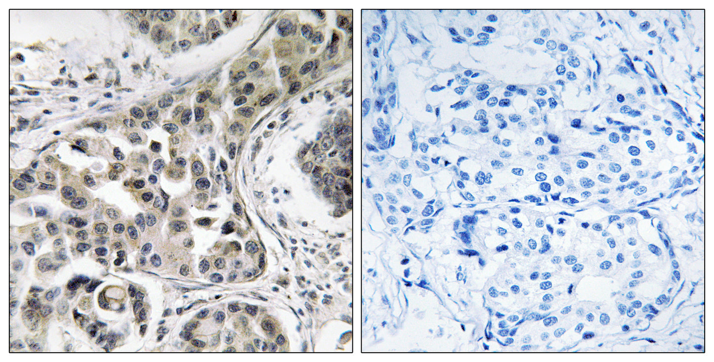 RN-tre Rabbit Polyclonal Antibody