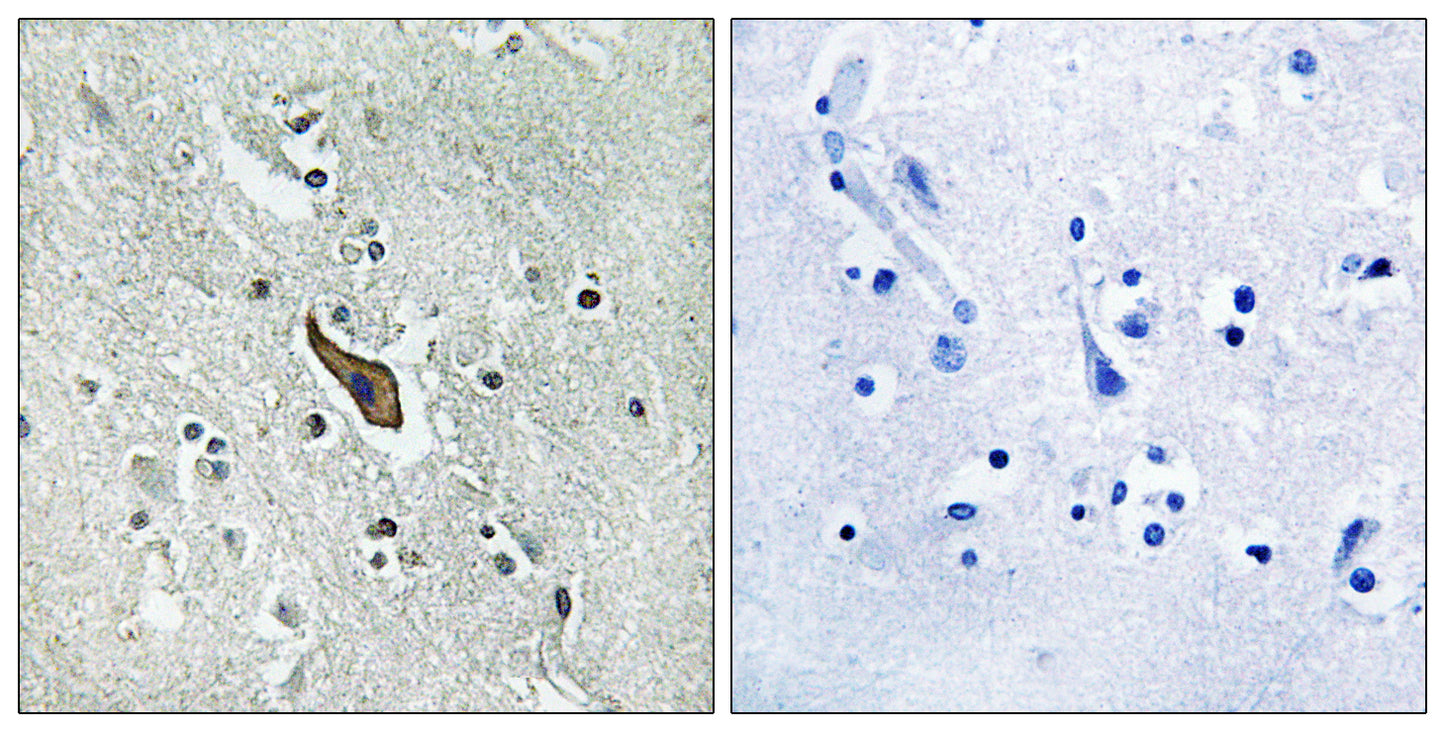 Robo2 Rabbit Polyclonal Antibody