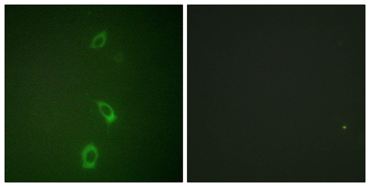 ROM-K Rabbit Polyclonal Antibody