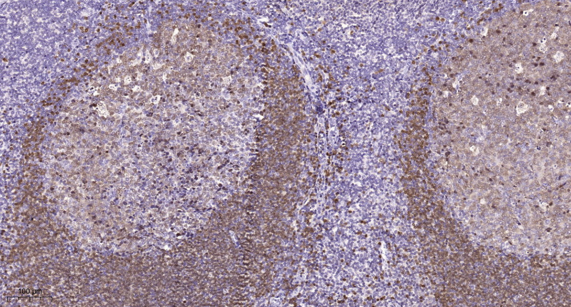RPA135 Rabbit Polyclonal Antibody